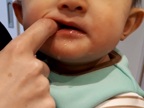 捏ねた粉薬を赤ちゃんの口に入れる写真